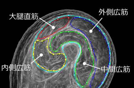 大腿部断面　イメージ